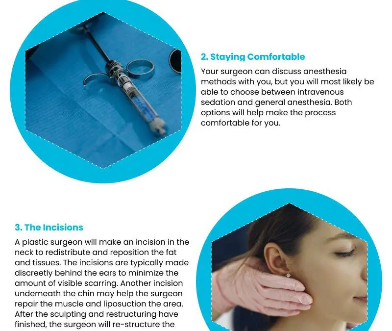 4 Things to Know Before Your Neck Lift Procedure