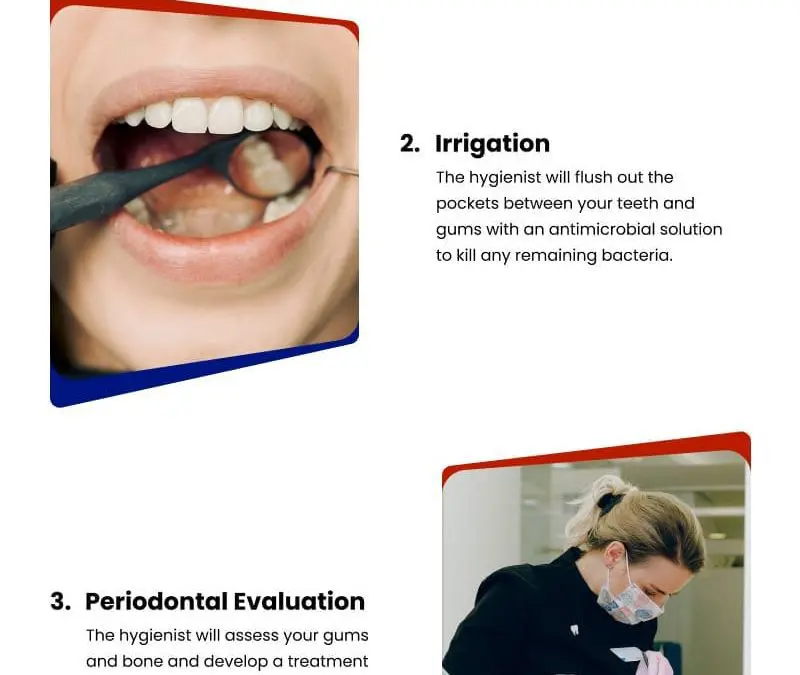 4 Easy Steps of  Periodontal Maintenance