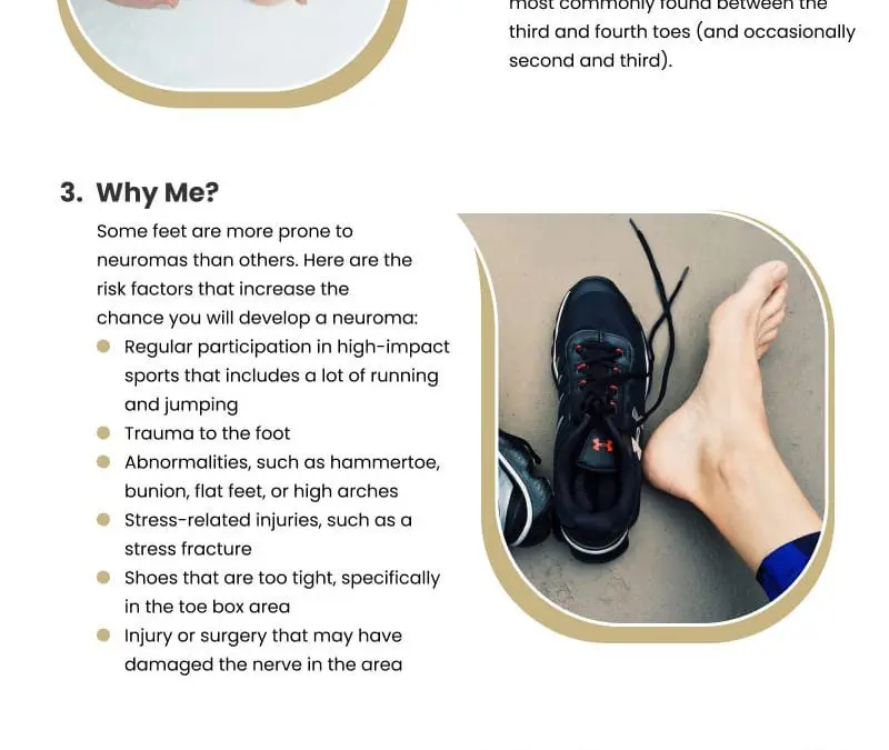 5 Facts on Foot Neuroma