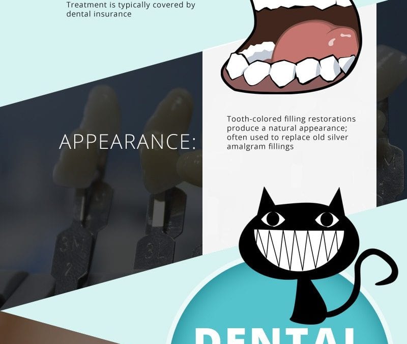 Benefits of Dental Fillings