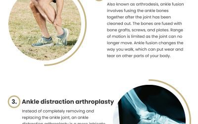 4 Ankle Arthritis Treatments