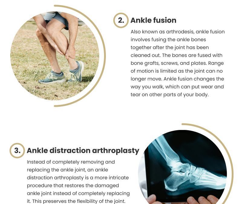 4 Ankle Arthritis Treatments