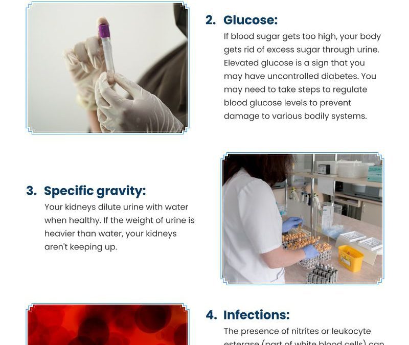 5 Urine Sample Test Results