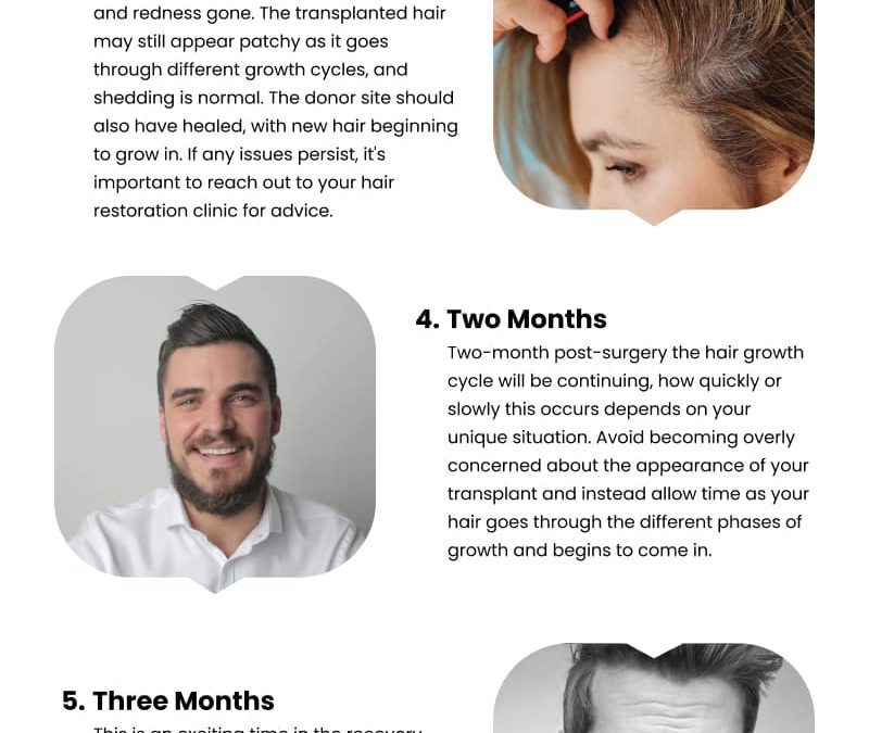 7 Expectations After Your Hair Transplant